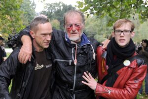 Protester with serious eye injury after police crackdown with water cannon in Stuttgart, Germany